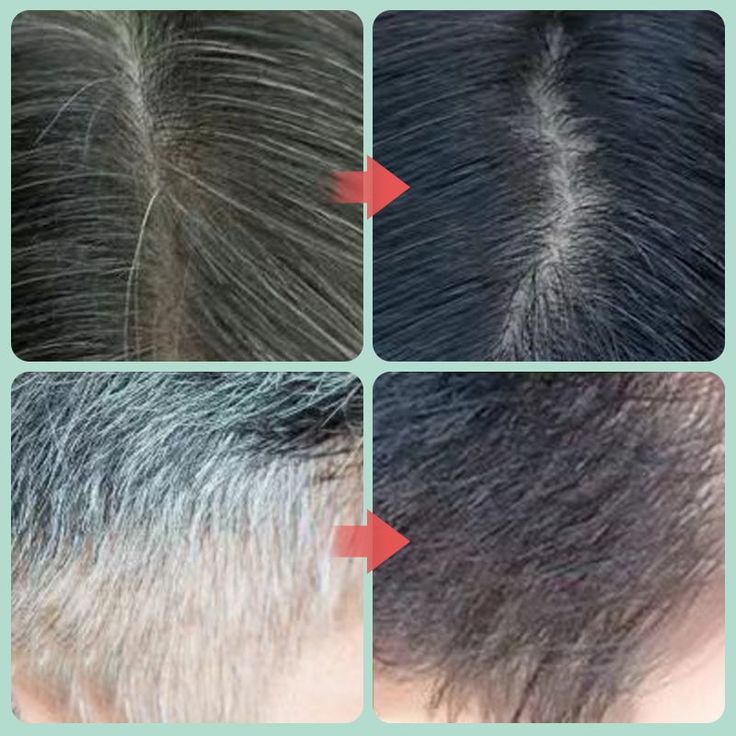BlackHair Plus - shampoo cubre canas